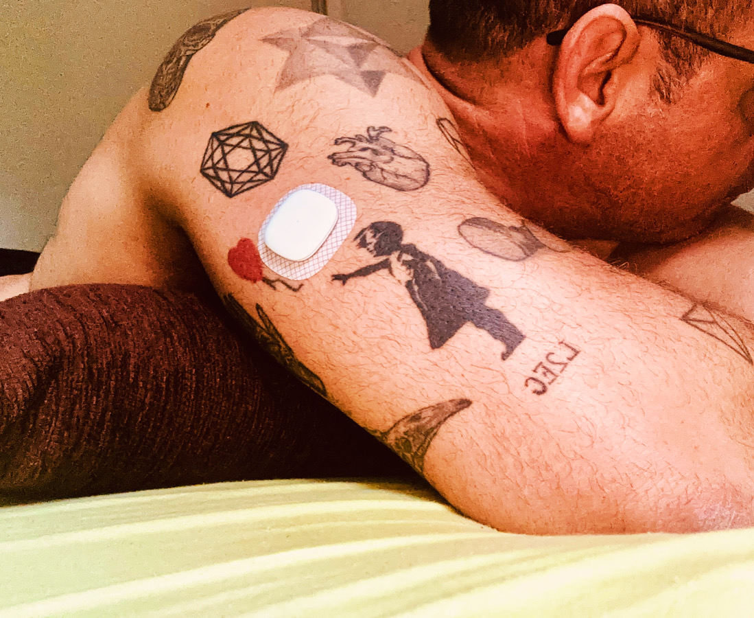 Sensor Simplera Medtronic Diabetes