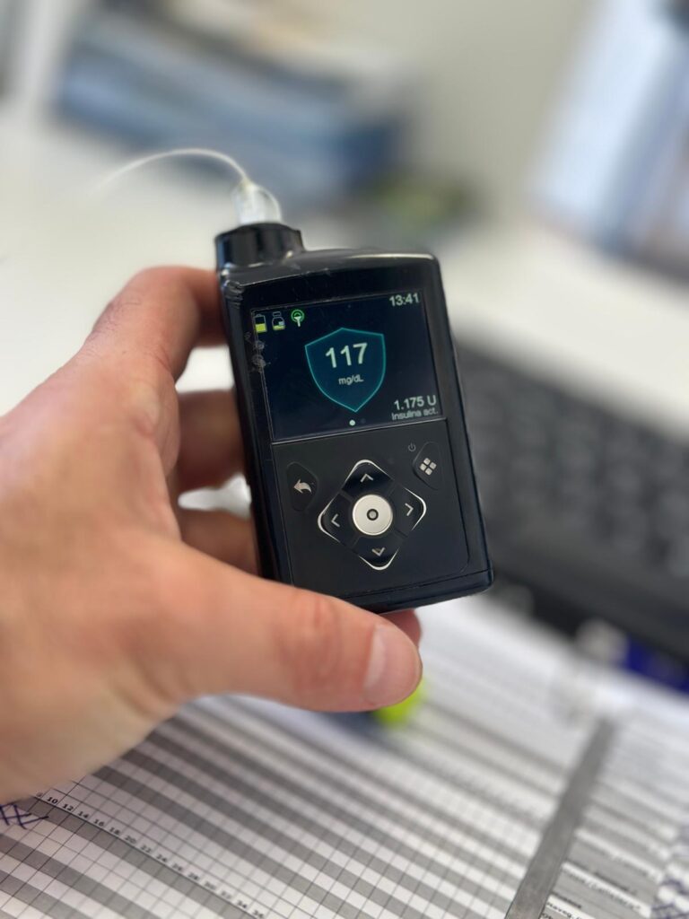 diabetes en el trabajo